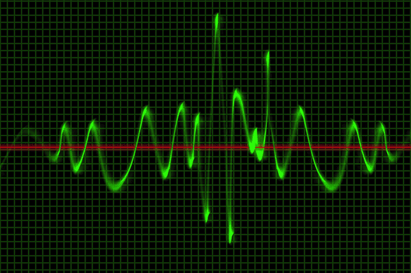 Les notions de phase et de déphasage d'un signal 